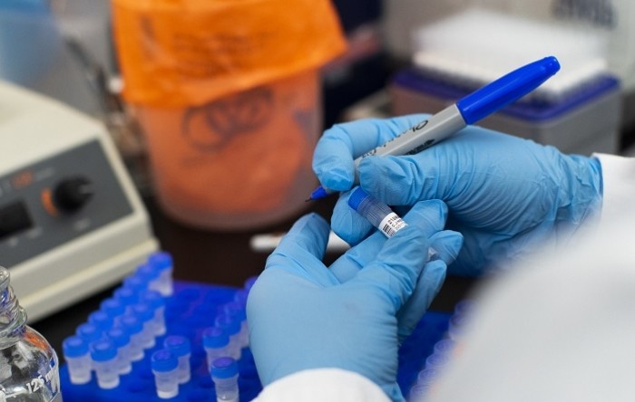 Slovačka planira testirati na koronavirus sve starije od deset godina