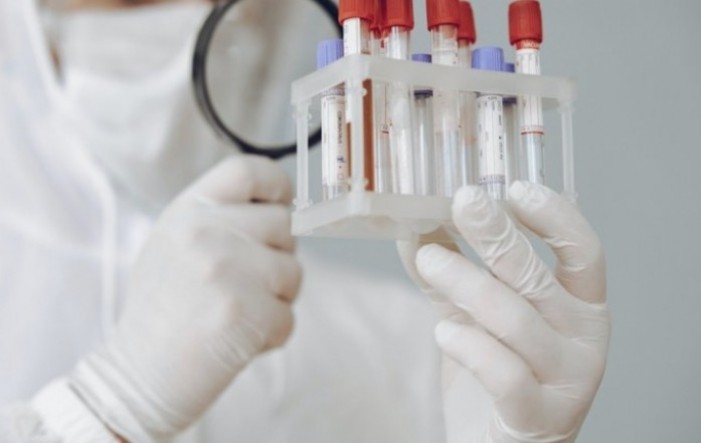 U Hrvatskoj 1.455 novih slučajeva zaraze koronavirusom, preminulo 12 osoba