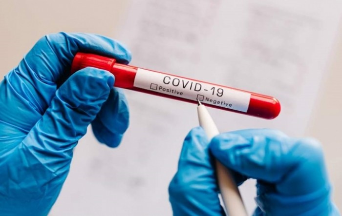 U Hrvatskoj 1.042 nova slučaja zaraze koronavirusom, umrlo osam osoba