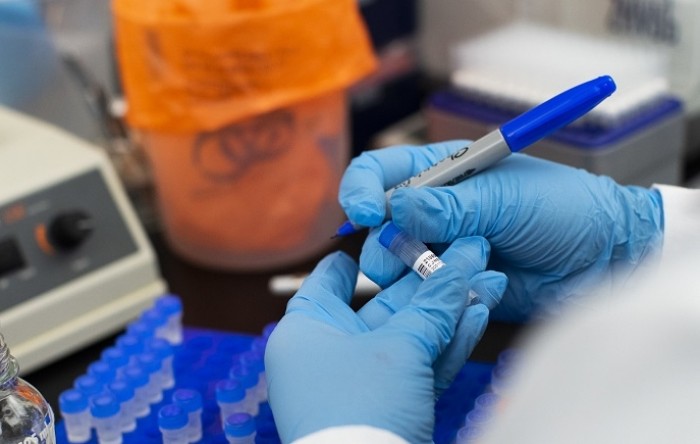 SAD postavio novi rekord s više od milijun testova na koronavirus u danu