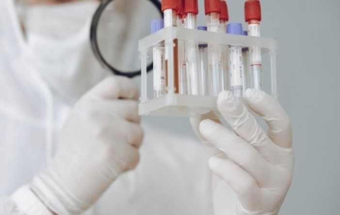 Zagušen sustav za PCR testove: Počinje masovno antigensko testiranje