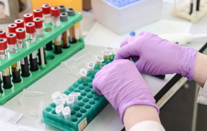 Štampar enormno zaradio na PCR testovima