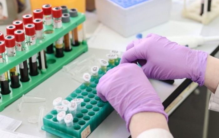 HZZO: Niže cijene PCR i serološkog testiranja na covid-19